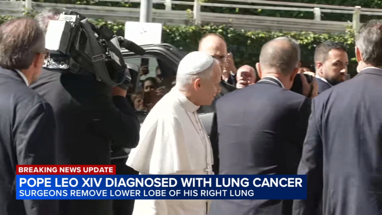 Pope surgery update: Vatican says Pope Leo XIV has lung cancer and the lower lobe of his right lung was removed
       — ABC 7 Bay Area, Carmel-by-the-Sea Community news